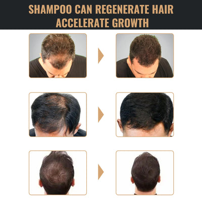Root Activator Shampoo, Natuurlijke Haargroei Shampoo, Unisex Haarverdikking Shampoo, Zachte Shampoo voor Mannen & Vrouwen, Voedende Langdurige Haarverzorging voor Donker & Dikker Haar Nexora Store